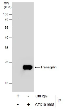 Transgelin antibody