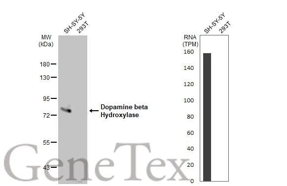 Various whole cell extracts (30 μg) were separated by 7.5% SDS-PAGE, and the membrane was blotted with Dopamine beta Hydroxylase antibody (GTX101616) diluted at 1:2000. The HRP-conjugated anti-rabbit IgG antibody (GTX213110-01) was used to detect the primary antibody. Corresponding RNA expression data for the same cell lines are based on Human Protein Atlas program.