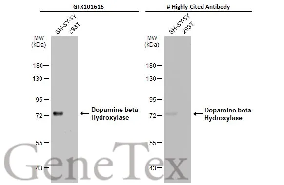 Various whole cell extracts (30 μg) were separated by 7.5% SDS-PAGE, and the membranes were blotted with Dopamine beta Hydroxylase antibody (GTX101616) diluted at 1:2000 and competitor's antibody diluted at 1:200. The HRP-conjugated anti-rabbit IgG antibody (GTX213110-01) was used to detect the primary antibody. *The competitor is not affiliated with GeneTex and does not endorse this product.