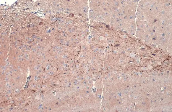 Dopamine beta Hydroxylase antibody detects Dopamine beta Hydroxylase protein at cytoplasm by immunohistochemical analysis. Sample: Paraffin-embedded mouse brain. Dopamine beta Hydroxylase stained by Dopamine beta Hydroxylase antibody (GTX101616) diluted at 1:500. Antigen Retrieval: Citrate buffer, pH 6.0, 15 min