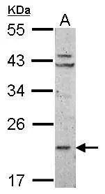 Sample (50 ug of whole cell lysate) A: mouse Liver 12% SDS PAGE GTX101651 diluted at 1:1000