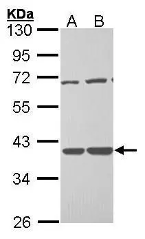 Sample (30 ug of whole cell lysate) A: H1299 B: Hela 10% SDS PAGE GTX101663 diluted at 1:1000 
