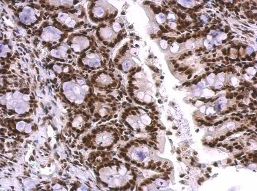 SNRPA antibody detects SNRPA protein at nucleus on mouse colon by immunohistochemical analysis. Sample: Paraffin-embedded mouse colon. SNRPA antibody (GTX101664) dilution: 1:500. 
 Antigen Retrieval: Trilogy? (EDTA based, pH 8.0) buffer, 15min