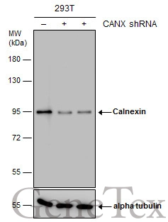 Non-transfected (–) and transfected (+) 293T whole cell extracts (15 μg) were separated by 7.5% SDS-PAGE, and the membrane was blotted with Calnexin antibody [N3C2], Internal (GTX101676) diluted at 1:10000. The HRP-conjugated anti-rabbit IgG antibody (GTX213110-01) was used to detect the primary antibody.