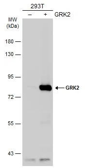 Non-transfected (–) and transfected (+) 293T whole cell extracts (30 μg) were separated by 7.5% SDS-PAGE, and the membrane was blotted with GRK2 antibody [C2C3], C-term (GTX101682) diluted at 1:1000. The HRP-conjugated anti-rabbit IgG antibody (GTX213110-01) was used to detect the primary antibody.