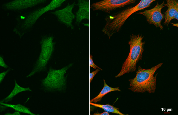 GRK2 antibody [C2C3], C-term detects GRK2 protein at cytoplasm by immunofluorescent analysis. Sample: HeLa cells were fixed in ice-cold MeOH for 5 min. Green: GRK2 stained by GRK2 antibody [C2C3], C-term (GTX101682) diluted at 1:1000. Red: alpha Tubulin, a cytoskeleton marker, stained by alpha Tubulin antibody [GT114] (GTX628802) diluted at 1:1000. Blue: Fluoroshield with DAPI (GTX30920).