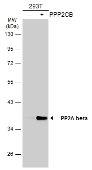 Non-transfected (–) and transfected (+) 293T whole cell extracts (30 μg) were separated by 10% SDS-PAGE, and the membrane was blotted with PP2A beta antibody (GTX101690) diluted at 1:1000. The HRP-conjugated anti-rabbit IgG antibody (GTX213110-01) was used to detect the primary antibody.