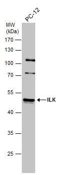 Whole cell extract (30 μg) was separated by 10% SDS-PAGE, and the membrane was blotted with ILK antibody [N1C1] (GTX101691) diluted at 1:500.