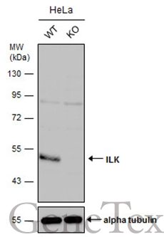 Wild-type (WT) and ILK knockout (KO) HeLa cell extracts (30 μg) were separated by 10% SDS-PAGE, and the membrane was blotted with ILK antibody [N1C1] (GTX101691) diluted at 1:500. The HRP-conjugated anti-rabbit IgG antibody (GTX213110-01) was used to detect the primary antibody.