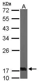 Sample (50 ug of whole cell lysate) A: Mouse brain 12% SDS PAGE GTX101706 diluted at 1:1000 Sample (50 ug of whole cell lysate) A: Mouse brain 12% SDS PAGE GTX101706 diluted at 1:1000