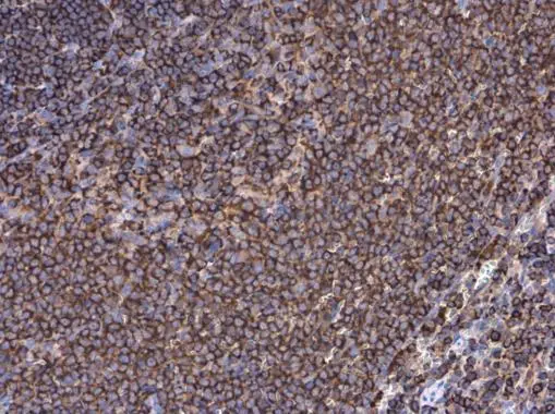 Moesin antibody [C2C3], C-term detects Moesin protein at cell membrane in rat spleen by immunohistochemical analysis. Sample: Paraffin-embedded rat spleen. Moesin antibody [C2C3], C-term (GTX101708) diluted at 1:500. 
 Antigen Retrieval: Citrate buffer, pH 6.0, 15 min