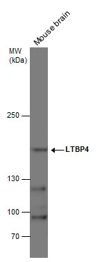 LTBP4 antibody [N1N2], N-term