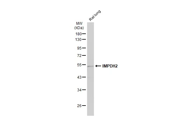 Rat tissue extract (50 μg) was separated by 10% SDS-PAGE, and the membrane was blotted with IMPDH2 antibody [N2C1], Internal (GTX101727) diluted at 1:500. The HRP-conjugated anti-rabbit IgG antibody (GTX213110-01) was used to detect the primary antibody.