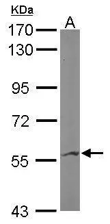 Sample (50 ug of whole cell lysate) A: Mouse brain 7.5% SDS PAGE GTX101727 diluted at 1:1000