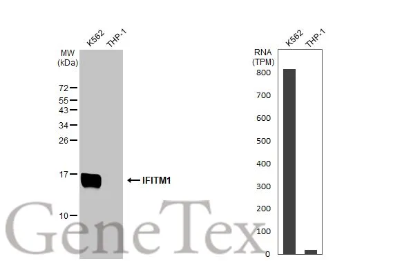Various whole cell extracts (30 μg) were separated by 15% SDS-PAGE, and the membrane was blotted with IFITM1 antibody (GTX101728) diluted at 1:500. The HRP-conjugated anti-rabbit IgG antibody (GTX213110-01) was used to detect the primary antibody. Corresponding RNA expression data for the same cell lines are based on Human Protein Atlas program. Various whole cell extracts (30 μg) were separated by 15% SDS-PAGE, and the membrane was blotted with IFITM1 antibody (GTX101728) diluted at 1:500. The HRP-conjugated anti-rabbit IgG antibody (GTX213110-01) was used to detect the primary antibody. Corresponding RNA expression data for the same cell lines are based on Human Protein Atlas program.