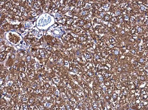 Ferritin Heavy Chain antibody [N1C3] detects Ferritin Heavy Chain protein at cytoplasm in rat liver by immunohistochemical analysis. Sample: Paraffin-embedded rat liver. Ferritin Heavy Chain antibody [N1C3] (GTX101733) diluted at 1:500. 
 Antigen Retrieval: Citrate buffer, pH 6.0, 15 min