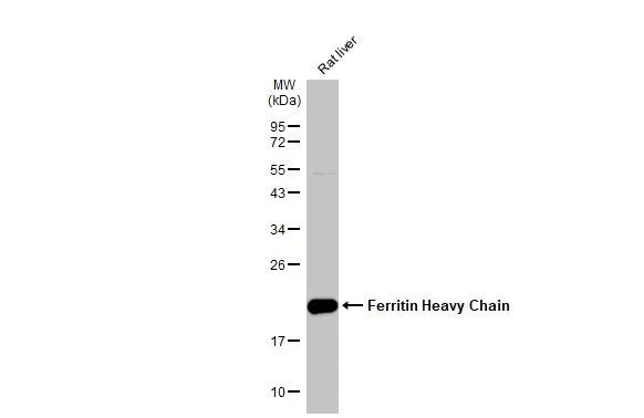 Anti-Ferritin Heavy Chain antibody [N1C3] (GTX101733) | GeneTex
