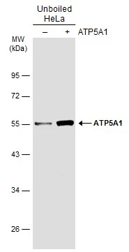 Non-transfected (–) and transfected (+) 293T whole cell extracts (30 μg) were separated by 10% SDS-PAGE, and the membrane was blotted with ATP5A1 antibody [C2C3], C-term (GTX101741) diluted at 1:1000. The HRP-conjugated anti-rabbit IgG antibody (GTX213110-01) was used to detect the primary antibody.