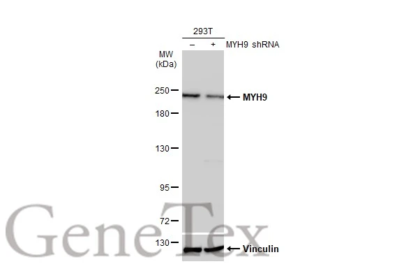 Non-transfected (–) and transfected (+) 293T whole cell extracts (30 μg) were separated by 5% SDS-PAGE, and the membrane was blotted with MYH9 antibody [N1], N-term (GTX101751) diluted at 1:2000. The HRP-conjugated anti-rabbit IgG antibody (GTX213110-01) was used to detect the primary antibody.