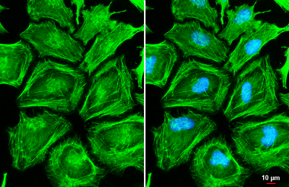 MYH9 antibody [N1], N-term detects MYH9 protein at cytoskeleton by immunofluorescent analysis. Sample: HeLa cells were fixed in ice-cold MeOH for 5 min. Green: MYH9 stained by MYH9 antibody [N1], N-term (GTX101751) diluted at 1:500. Blue: Fluoroshield with DAPI (GTX30920). Scale bar= 10 μm.