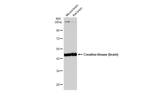 Various tissue extracts (50 μg) were separated by 10% SDS-PAGE, and the membrane was blotted with Creatine kinase (brain) antibody [N1C1] (GTX101759) diluted at 1:1000. The HRP-conjugated anti-rabbit IgG antibody (GTX213110-01) was used to detect the primary antibody.