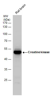 Creatine kinase (brain) antibody detects Creatine kinase protein by western blot analysis. Rat tissue extracts (50 μg) was separated by 10% SDS-PAGE, and blotted with Creatine kinase (brain) antibody (GTX101760) diluted by 1:1000. The HRP-conjugated anti-rabbit IgG antibody (GTX213110-01) was used to detect the primary antibody.