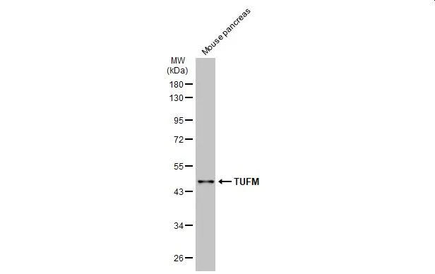 Mouse tissue extract (50 μg) was separated by 10% SDS-PAGE, and the membrane was blotted with TUFM antibody (GTX101763) diluted at 1:1000. The HRP-conjugated anti-rabbit IgG antibody (GTX213110-01) was used to detect the primary antibody.