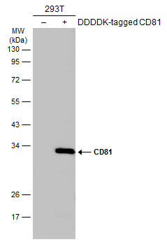 Non-transfected (�) and transfected (+) 293T whole cell extracts (30 ug) were separated by 12% SDS-PAGE,and the membrane was blotted with CD81 antibody (GTX101766) diluted at 1:1000.
