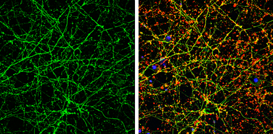 Calmodulin antibody detects Calmodulin protein by immunofluorescent analysis. Sample: DIV9 rat E18 primary cortical neuron cells were fixed in 4% paraformaldehyde at RT for 15 min. Green: Calmodulin stained by Calmodulin antibody (GTX101767) diluted at 1:500. Red: beta Tubulin 3/ Tuj1, stained by beta Tubulin 3/ Tuj1 antibody [GT1338] (GTX631831) diluted at 1:500. Blue: Fluoroshield with DAPI (GTX30920).