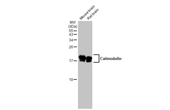 Various tissue extracts (50 μg) were separated by 15% SDS-PAGE, and the membrane was blotted with Calmodulin antibody (GTX101767) diluted at 1:1000. The HRP-conjugated anti-rabbit IgG antibody (GTX213110-01) was used to detect the primary antibody.