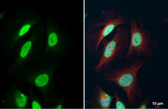 FEN1 antibody detects FEN1 protein at nucleus by immunofluorescent analysis. Sample: HeLa cells were fixed in 4% paraformaldehyde at RT for 15 min. Green: FEN1 stained by FEN1 antibody (GTX101777) diluted at 1:500. Red: alpha Tubulin, a cytoskeleton marker, stained by alpha Tubulin antibody [GT114] (GTX628802) diluted at 1:1000. Blue: Fluoroshield with DAPI (GTX30920).