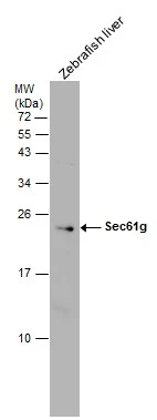 Zebrafish tissue extract (30 μg) was separated by 15% SDS-PAGE, and the membrane was blotted with Sec61 gamma subunit antibody (GTX101782) diluted at 1:500. Zebrafish tissue extract (30 μg) was separated by 15% SDS-PAGE, and the membrane was blotted with Sec61 gamma subunit antibody (GTX101782) diluted at 1:500.