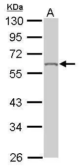 Sample (50 μg of whole cell lysate) A: Mouse brain 10% SDS PAGE GTX101786 diluted at 1:1000 The HRP-conjugated anti-rabbit IgG antibody (GTX213110-01) was used to detect the primary antibody.