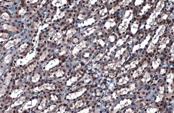hnRNP K antibody detects hnRNP K protein at nucleus by immunohistochemical analysis. Sample: Paraffin-embedded rat kidney. hnRNP K stained by hnRNP K antibody (GTX101786) diluted at 1:1000. Antigen Retrieval: Citrate buffer, pH 6.0, 15 min