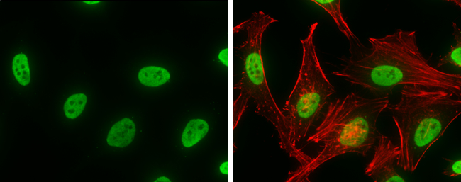 hnRNP K antibody detects hnRNP K protein at nucleus by immunofluorescent analysis. Sample: HeLa cells were fixed in 4% paraformaldehyde at RT for 15 min. Green: hnRNP K stained by hnRNP K antibody (GTX101786) diluted at 1:500. Red: phalloidin, a cytoskeleton marker, diluted at 1:100.