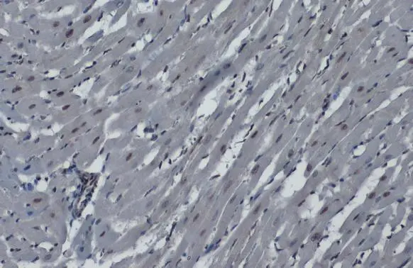 hnRNP K antibody detects hnRNP K protein at nucleus by immunohistochemical analysis. Sample: Paraffin-embedded rat heart. hnRNP K stained by hnRNP K antibody (GTX101786) diluted at 1:1000. Antigen Retrieval: Citrate buffer, pH 6.0, 15 min