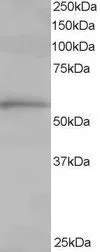 WB analysis of human lung lysate using GTX10180 TCP1 alpha antibody, C-term. Dilution : 1microg/ml Loading : 35microg protein in RIPA buffer WB analysis of human lung lysate using GTX10180 TCP1 alpha antibody, C-term. Dilution : 1microg/ml Loading : 35microg protein in RIPA buffer