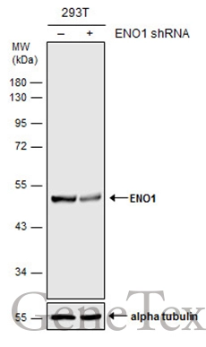 Sample (50 ug of whole cell lysate) A: Mouse brain 10% SDS PAGE GTX101803 diluted at 1:1000 The HRP-conjugated anti-rabbit IgG antibody (GTX213110-01) was used to detect the primary antibody.