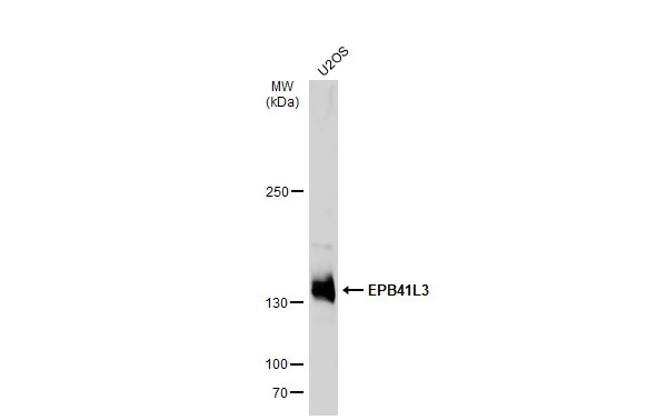 Whole cell extract (30 μg) was separated by 5% SDS-PAGE, and the membrane was blotted with EPB41L3 antibody [C3], C-term (GTX101805) diluted at 1:500. The HRP-conjugated anti-rabbit IgG antibody (GTX213110-01) was used to detect the primary antibody.