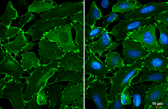EPB41L3 antibody [C3], C-term detects EPB41L3 protein at cell membrane by immunofluorescent analysis. Sample: U2OS cells were fixed in 4% paraformaldehyde at RT for 15 min. Green: EPB41L3 stained by EPB41L3 antibody [C3], C-term (GTX101805) diluted at 1:1000. Blue: Fluoroshield with DAPI (GTX30920). Scale bar= 10 μm.