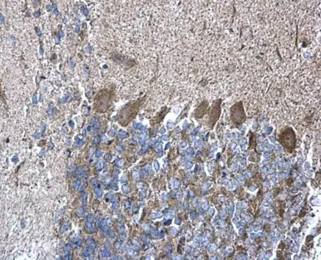 RPL5 antibody detects RPL5 protein at cytoplasm on mouse hind brain by immunohistochemical analysis. Sample: Paraffin-embedded mouse hind brain. RPL5 antibody (GTX101821) diluted at 1:500. 
 Antigen Retrieval: Trilogy? (EDTA based, pH 8.0) buffer, 15min