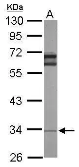Sample (50 μg of whole cell lysate) A: Mouse brain 10% SDS PAGE GTX101821 diluted at 1:1000 The HRP-conjugated anti-rabbit IgG antibody (GTX213110-01) was used to detect the primary antibody.