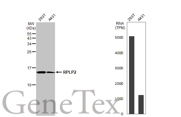 Various whole cell extracts (30 μg) were separated by 15% SDS-PAGE, and the membrane was blotted with RPLP2 antibody (GTX101823) diluted at 1:10000. The HRP-conjugated anti-rabbit IgG antibody (GTX213110-01) was used to detect the primary antibody. Corresponding RNA expression data for the same cell lines are based on Human Protein Atlas program.