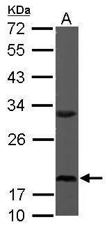 Sample (50 μg of whole cell lysate) A: Mouse brain 12% SDS PAGE GTX101836 diluted at 1:1000 The HRP-conjugated anti-rabbit IgG antibody (GTX213110-01) was used to detect the primary antibody.