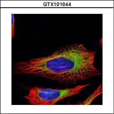 Confocal immunofluorescence analysis (Olympus FV10i) of paraformaldehyde-fixed HeLa,using Ribosome binding protein 1(GTX101844) antibody (Green) at 1:500 dilution. Alpha-tubulin filaments were labeled with GTX11304 (Red) at 1:500.
