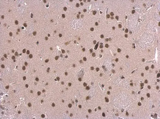 SNRPD2 antibody detects SNRPD2 protein at nucleus on mouse fore brain by immunohistochemical analysis. Sample: Paraffin-embedded mouse fore brain. SNRPD2 antibody (GTX101846) dilution: 1:500. 
 Antigen Retrieval: Trilogy? (EDTA based, pH 8.0) buffer, 15min