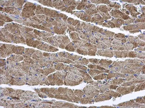 ENTPD6 antibody [N1C1]