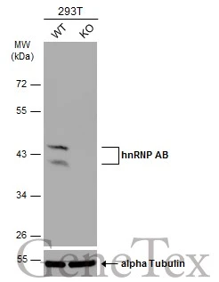 Wild-type (WT) and hnRNP AB knockout (KO) 293T cell extracts (30 μg) were separated by 10% SDS-PAGE, and the membrane was blotted with hnRNP AB antibody (GTX101852) diluted at 1:1000. The HRP-conjugated anti-rabbit IgG antibody (GTX213110-01) was used to detect the primary antibody. Wild-type (WT) and hnRNP AB knockout (KO) 293T cell extracts (30 μg) were separated by 10% SDS-PAGE, and the membrane was blotted with hnRNP AB antibody (GTX101852) diluted at 1:1000. The HRP-conjugated anti-rabbit IgG antibody (GTX213110-01) was used to detect the primary antibody.