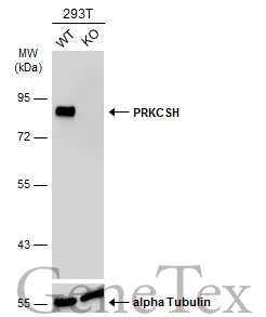 Wild-type (WT) and PRKCSH knockout (KO) 293T cell extracts (30 μg) were separated by 7.5% SDS-PAGE, and the membrane was blotted with PRKCSH antibody (GTX101856) diluted at 1:10000. The HRP-conjugated anti-rabbit IgG antibody (GTX213110-01) was used to detect the primary antibody.