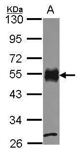 Sample (30 ug of whole cell lysate) A: JurKat 10% SDS PAGE CD2 antibody GTX101858 diluted at 1:1000 